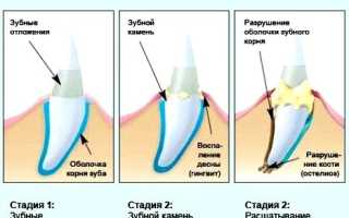 Удаляем зубной камень у кошек дома и у ветеринара